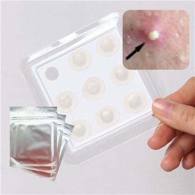 Garżi tal-Post tal-Akne